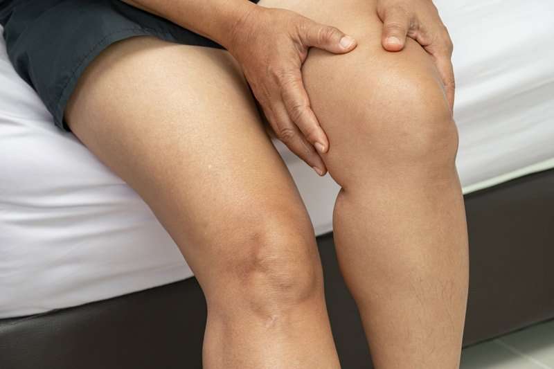 Mujer con dolor por piernas hinchadas