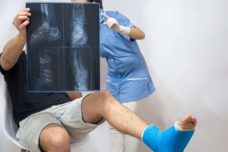 Evaluación médica de radiografías tras fractura de pie antes de iniciar el apoyo